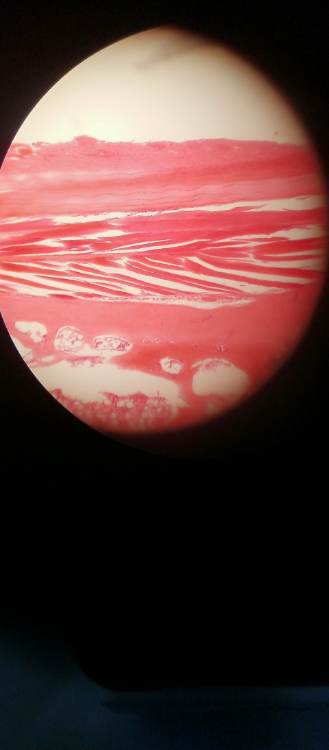 Muscle cell under a microscope